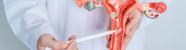 Lékař ukazuje polyp v děložním čípku na modelu.