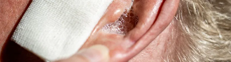 Ear with discharge and bandage