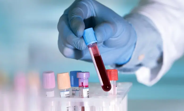 Ruka v rukavici drží zkumavku s krví pro laboratorní vyšetření.