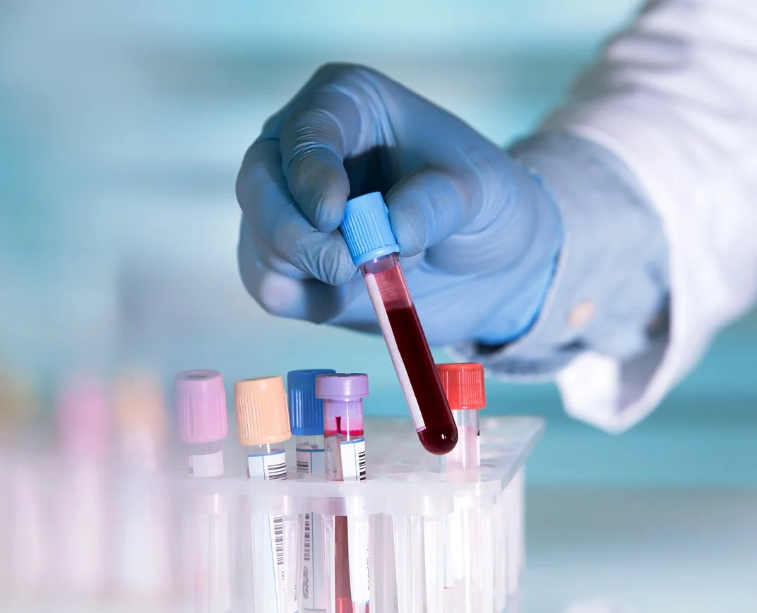 Ruka v rukavici drží zkumavku s krví pro laboratorní vyšetření.