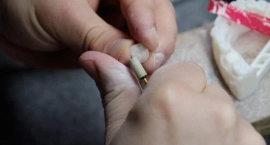 Ruční úprava zubního náhrady na modelu v laboratoři.