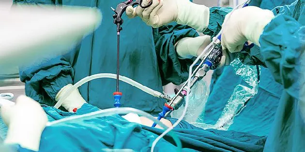 Laparoskopická operace s endoskopy v břišní dutině