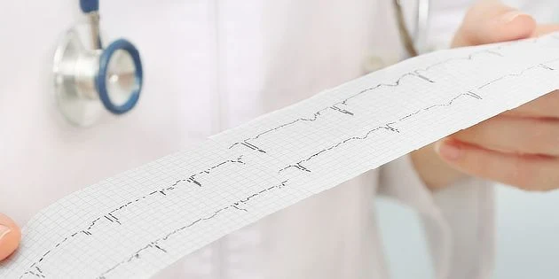 Lékař drží EKG papír s vlnami srdečního rytmu