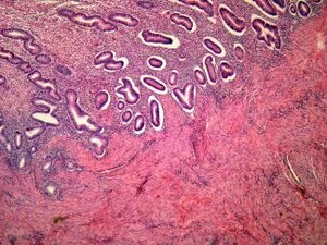 Histologický snímek sliznice dělohy s žlázami a stromou.